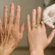 Lipotransfer na dłonie – czy naprawdę odmładza i wygładza bruzdy?